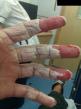 23-skinless-fingers.jpg