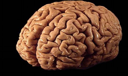 mozek.jpg