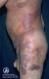 festered-skin-disease109.jpg