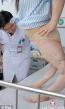 chinese-woman-with-twisted-legs-02-thumb.jpg