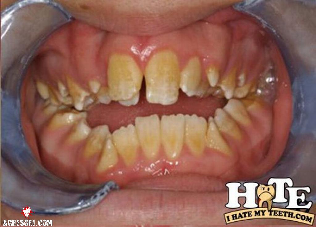 the-worst-teeth-ever-11-thumb.jpg