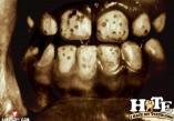 the-worst-teeth-ever-22-thumb.jpg