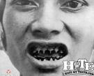 the-worst-teeth-ever-31-thumb.jpg