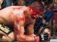 ufc-blood.jpg