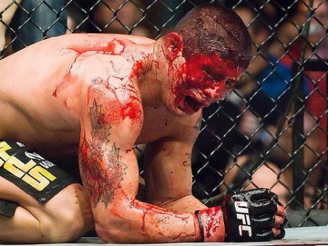 ufc-blood.jpg