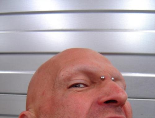 facelift.jpg