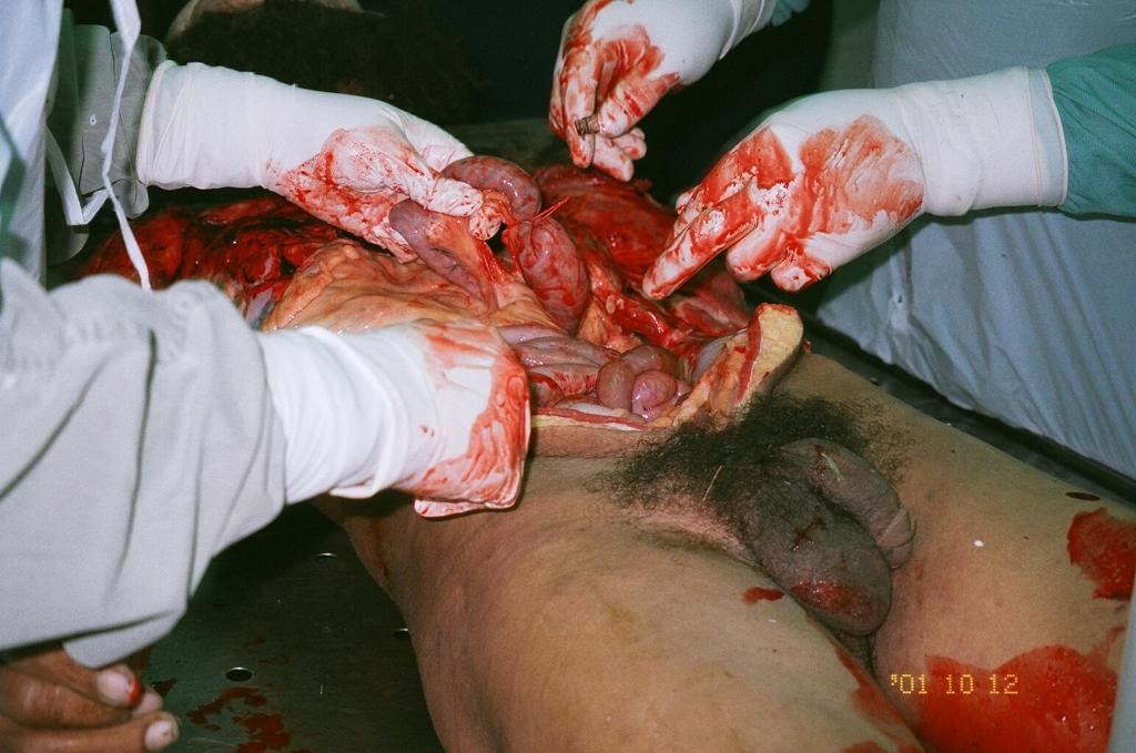 gastricgore-1.jpg