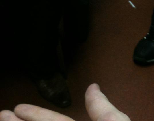 hand-burn.jpg