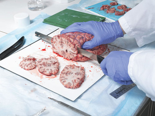 sliced-brain.jpg