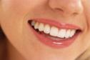 whiten-teeth-300x200.jpg