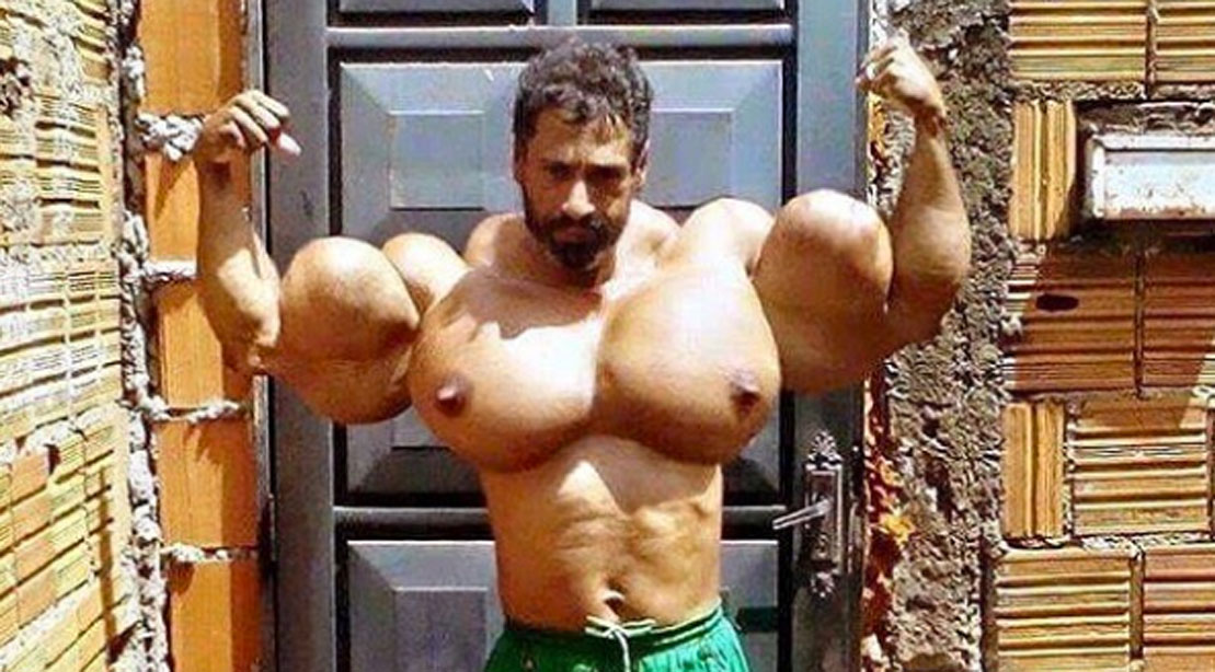 synthol.jpg