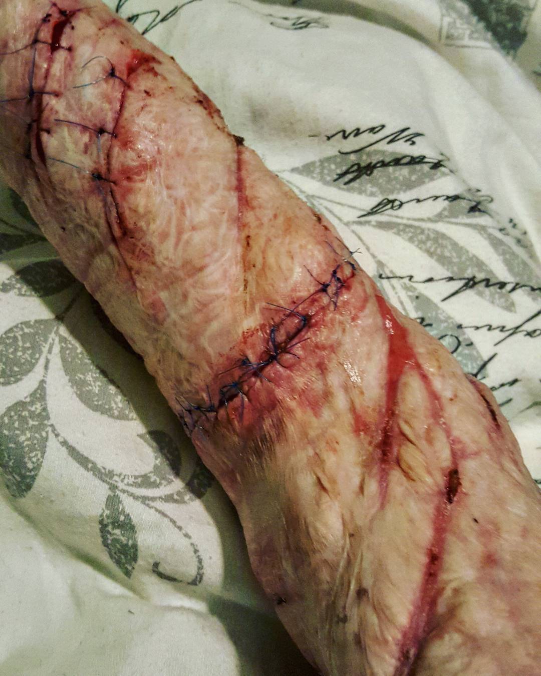 Coldnessinmyheart pictures