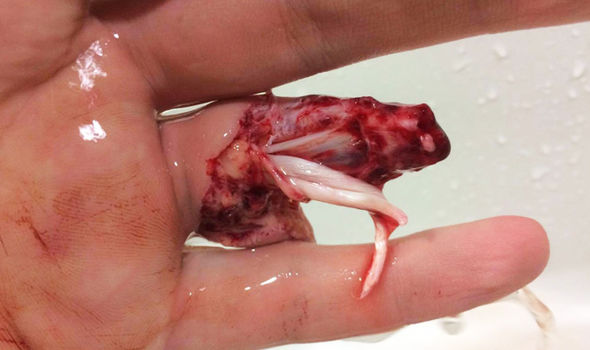 finger-stump-533539.jpg