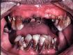 methmouth-image-02.jpg