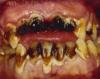 methmouth-newmm-8.jpg