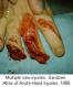 festered-limbs-feet-fingers066.jpg