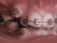 08-teeth.jpg