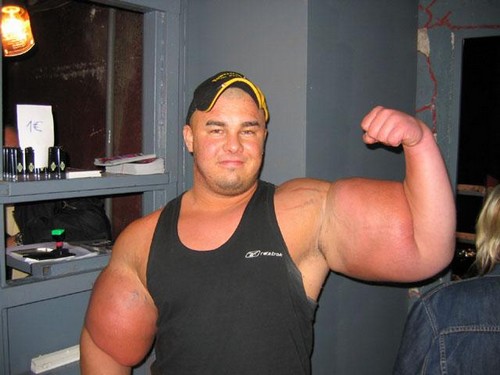 synthol-dickhead.jpg