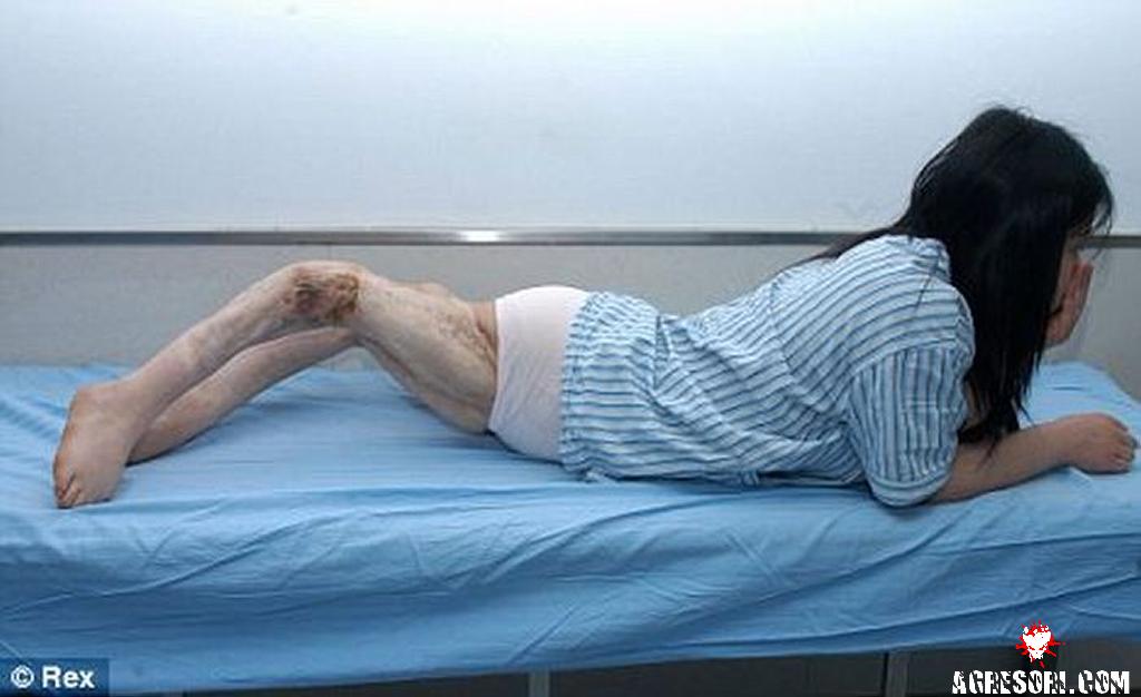 chinese-woman-with-twisted-legs-04-thumb.jpg